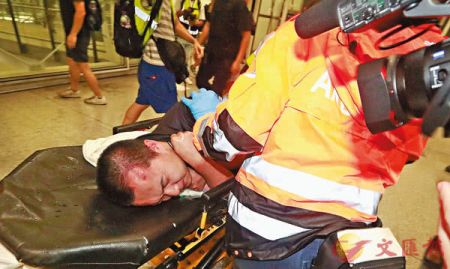 遭暴徒殴打，被送往医院的环球网记者付国豪 图片来源：香港文匯网